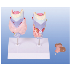 Thyroid pathology model